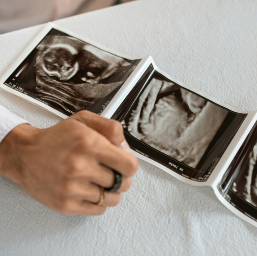 La IA puede ayudar en el proceso de fecundación in vitro 