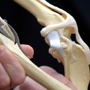 Huesos artificiales con impresoras 3D- ÓN